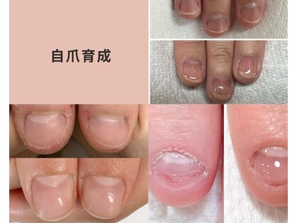 グレイス(GRACE)の写真