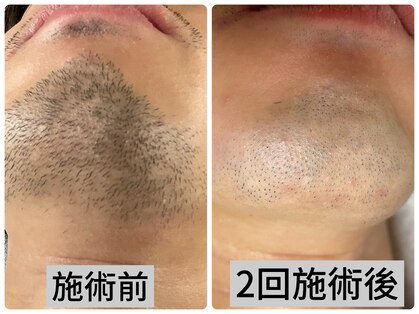 ラブラッシュ 恵比寿(LOVELASH)の写真
