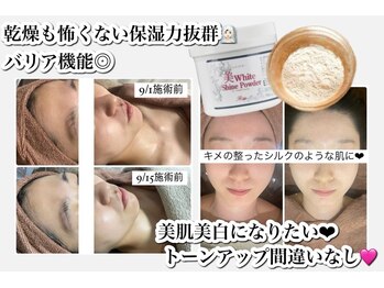 ホワイトアクア 福岡天神店(WHITE AQUA)/ハーブピーリングと一緒に！