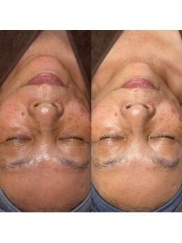 エミナル(EMINALu)/くすみ／美白／艶肌