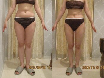 プロラボスパ 岡山店/20代後半　症例写真