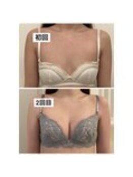美人バスト 表参道店/ バストアップ症例/育乳/2回目