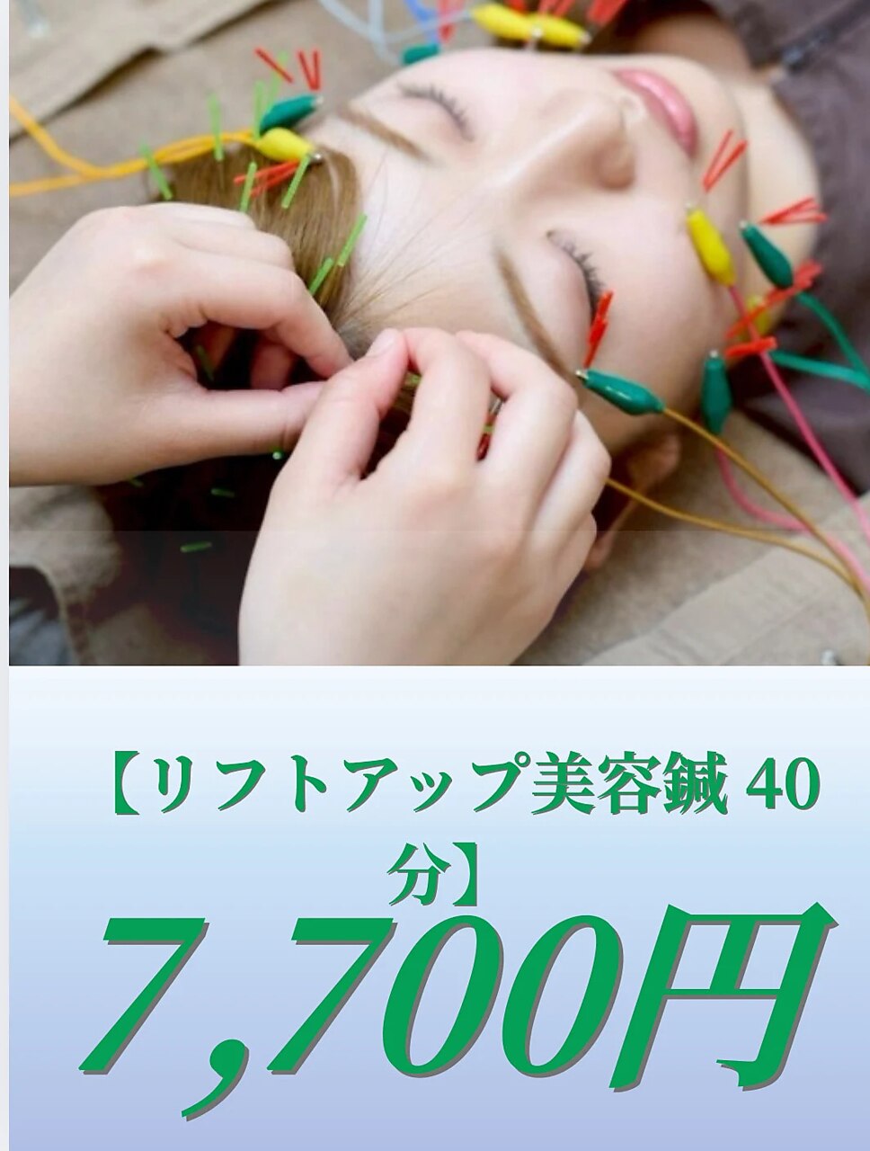 【リフトアップ美容鍼40分】　美容鍼　7700円