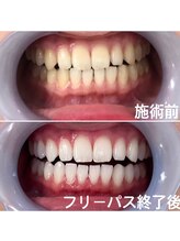 ルブラン 奈良店(Le Blanc)/白さメンテナンスで維持を。。。