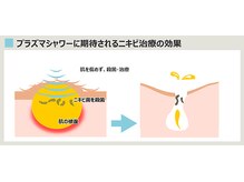 ハウピア(Haupia)/ニキビ菌・常在菌を殺菌