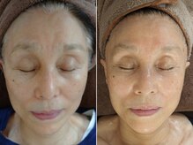 ミューク 自由が丘(mjuk)/細胞から若々しく！セルラムケア