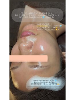 シュシュ(chouchou)/つやっつやの水光肌に