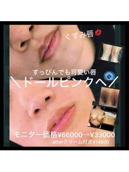 ココスタイルビューティー(COCOSTYLE beauty)の写真/最新マシン☆たるみ、ゆるみ、美白、美肌、一気改善できる優れマシーン★唇等のくすみケアドールピンク