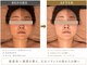 ヴィ ボーテ(Vie beaute)の写真/【小顔コルギ専門店】都度払いＯＫで無理な勧誘なし！
無理なくお通いいただけます♪