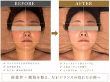 ヴィ ボーテ(Vie beaute)