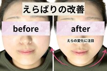 ゼン整体(ZEN)