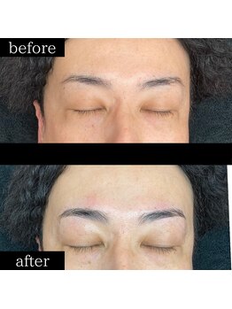 ユー 千葉駅前店(you)/メンズ眉毛/メンズ眉/千葉駅