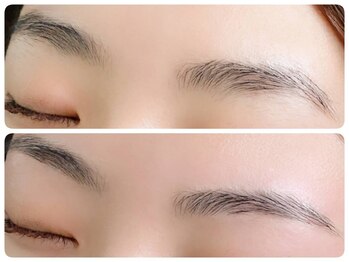 トータルビューティ ノイド(Noid)/眉WAX脱毛１回