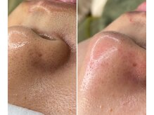 サイ(Sai)/before⇒after