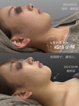 クレビア(CREBIA)/