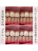 ブリエ(BRILLER)/高効果ホワイトニング　１デイ