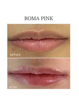 アンドワイ バイ サロンリーナ(&y by Salon Lena)/【ローマピンク &nbsp;RIP】