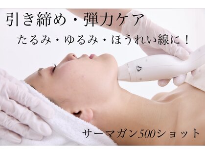 ピュルテの写真