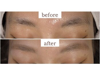 ヒビキ(Hibiki)/HBL before→after