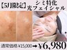 【5月限定】シミケア!光フェイシャル当て放題 ¥15000→