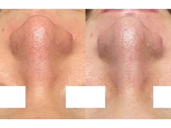 サロン ド レイ(Salon de Rei)/陶肌REVトリートメント