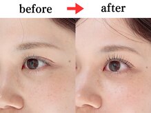 リア 自由が丘(REA)/まつげパーマ