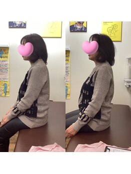 ヒデ整体院(Hide整体院)/猫背矯正骨盤矯正B/A肩こり腰痛