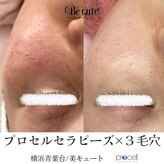 美キュート