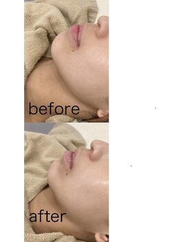 ティアム バイ テトテ 神戸三宮(TIAM by tetote)/ララピール