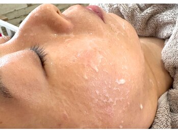 海真堂鍼灸整骨院/02)ゾンビマスク