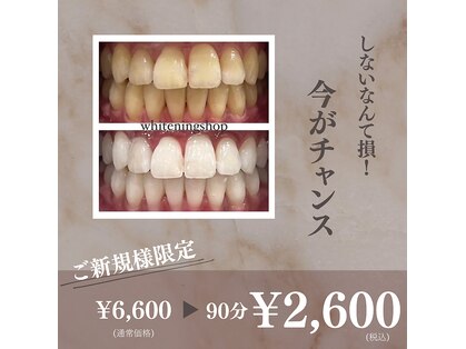 ホワイトニングショップ 出雲店の写真
