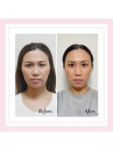 ル フラーズ(Les Fleurs)/左右差