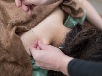 名古屋鍼灸 美容健康院の写真/首・肩まわりのつらさに★本来備わっている身体の回復力に着目し巡りを整え、美容と健やかさをサポート◎