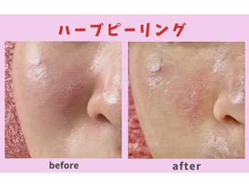 サロン ほほえむ(Fofo-m)/