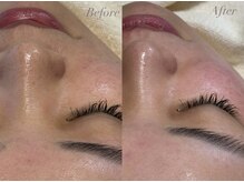 ファミーユ 太田(Fameu)/エステ版ダーマ