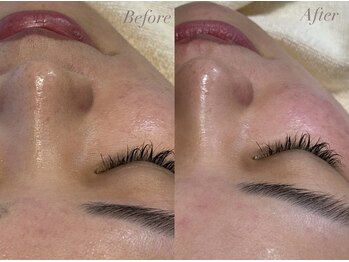 ファミーユ 太田(Fameu)/エステ版ダーマ