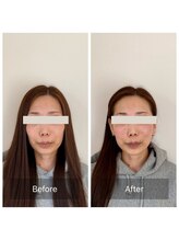 ハリラボ(hari Lab.)/【お客様の声】