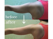 スパチャーレ(Spa ciare)/【トーンヌール】before＆after