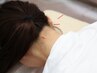 【☆初心者コース☆】鍼灸30分＋骨盤矯正30分/6,000円