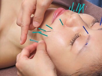 ビハダ(BIHADA)/国産最高級の鍼を使用♪