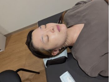 中総持寺鍼灸院【肩こり/肩甲骨/腰痛/姿勢矯正/美容鍼】/