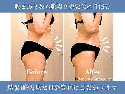 サンティエールの写真