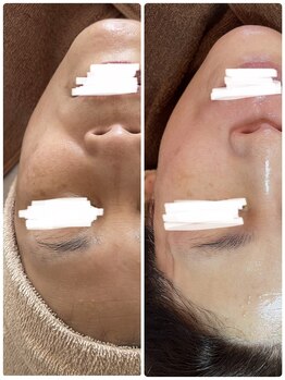 サロンニーナ(Salon.Nina)/韓国肌管理セルマン