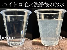 ラグレ(LUXRE)の雰囲気（当店の毛穴洗浄はピーリングパックで角栓を溶かし浮かせて吸引！）