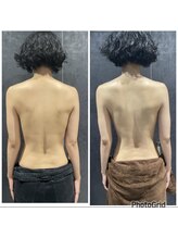 エステサロンブランシュ(Esthe salon Blanche)/ハーブピーリングで背中ケア