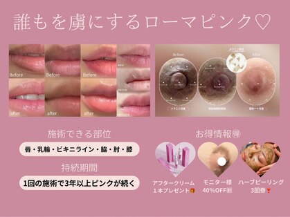 リラクゼーション つぼみの写真