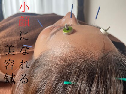 高松市なつめ鍼灸整体院の写真