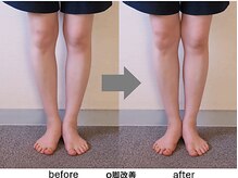 自由が丘の整体 ナチュラルカイロプラクティック院の雰囲気（o脚を骨格から根本改善！お悩みをご相談ください。【Ｏ脚矯正】）