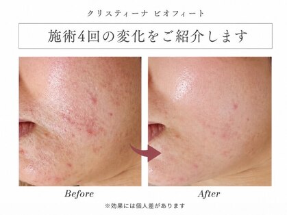 グランツ(Glanz)の写真