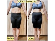 エステサロン ロータス(Lotus)の雰囲気（冷え・むくみ・代謝を刺激する全身のツボ押し【30日間の結果☆】）